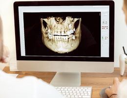 X-Ray of jaw and skull bone