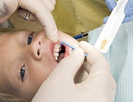 Child receiving fluoride treatment