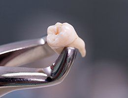 Metal clasps holding extracted tooth