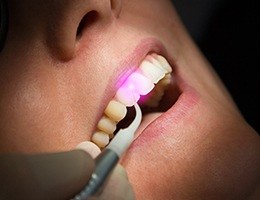 Patient receiving soft tissue laser dentistry treatment