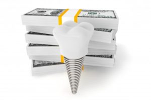 dental implant with money
