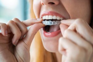 woman putting on Invisalign tray