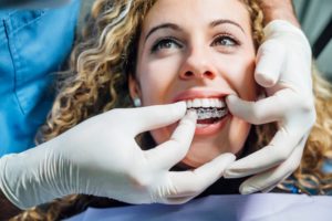 a woman at the dentist getting Invisalign treatment